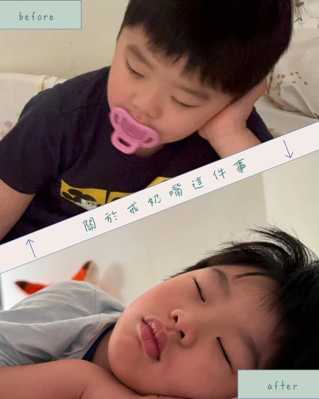 上下對照的兩張照片，標題寫著「關於戒奶嘴這件事」。上半張標示 before，又又側躺著含著粉紅色奶嘴、手撐著臉頰；下半張標示 after，他沒有含奶嘴，趴著熟睡